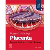 Diagnostic Pathology: Placenta