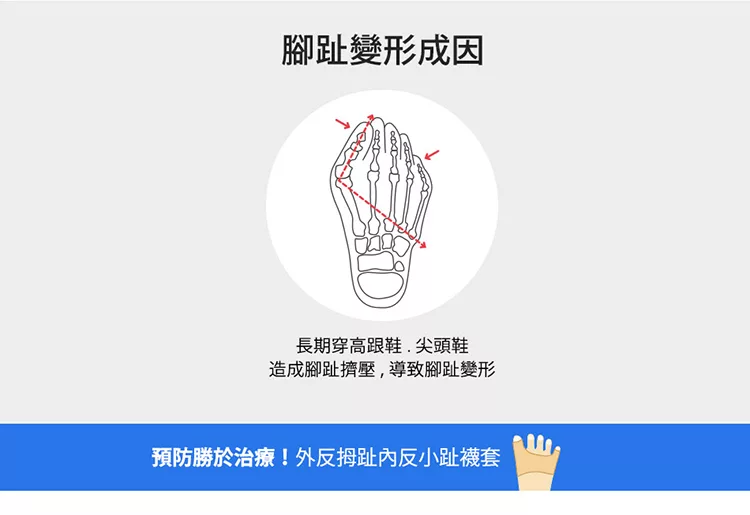 博客來 蒂巴蕾外反拇趾內反小趾健康軟墊 2雙入膚 博客來 蒂巴蕾外反拇趾內反小趾健康軟墊 2雙入膚